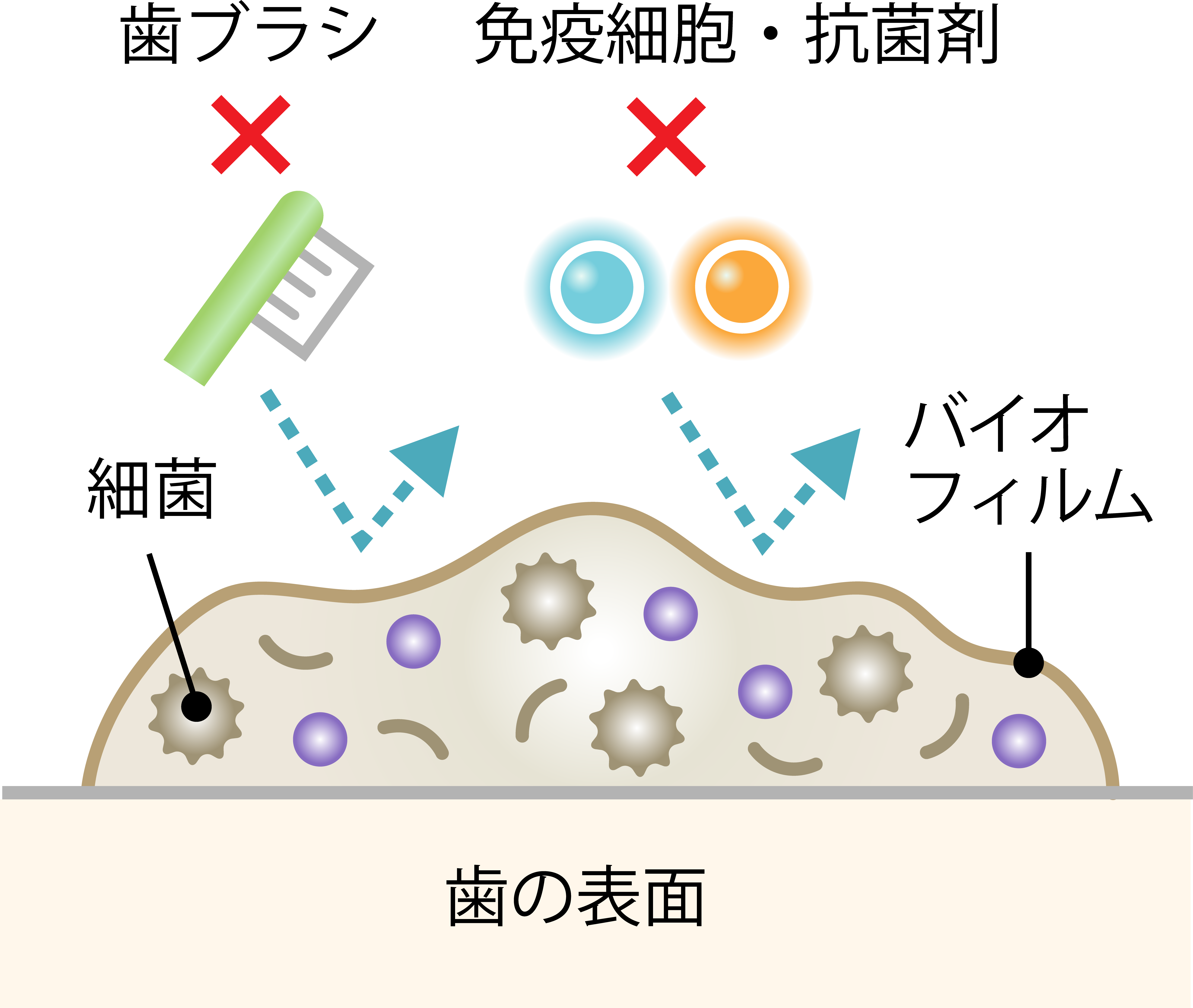 堺市西区の歯医者さん、諏訪ノ森歯科・矯正歯科の歯周病治療