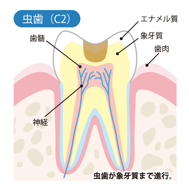 堺市西区の歯医者さん、諏訪ノ森歯科・矯正歯科の一般歯科