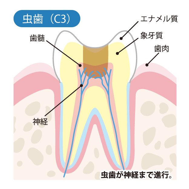 堺市西区の歯医者さん、諏訪ノ森歯科・矯正歯科の一般歯科