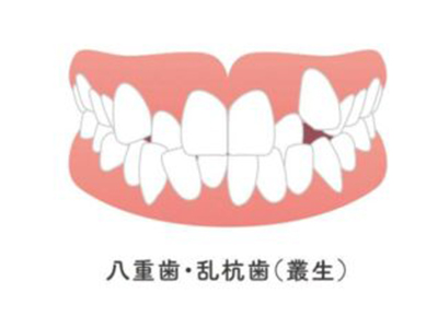 堺市西区の歯医者さん、諏訪ノ森歯科・矯正歯科の歯並びが気になる方へ